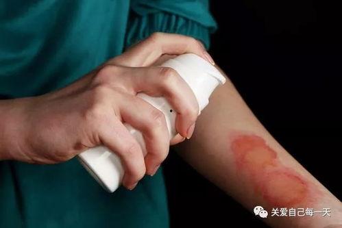 被烫伤敢吃凉瓜吗吗,揭秘饮食恢复之道